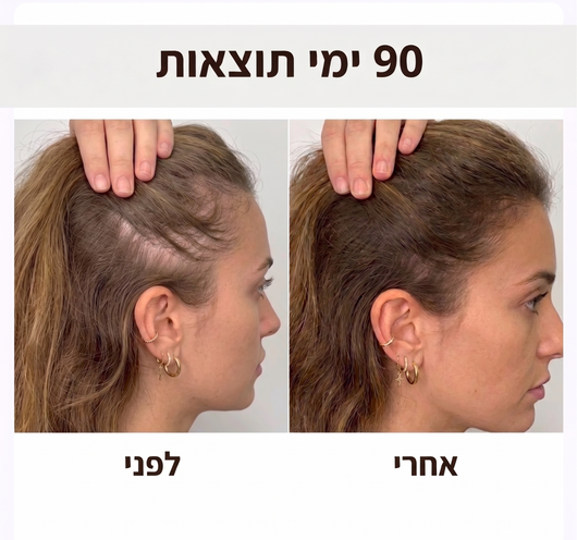 GrowGlow מברשת 4 ב-1 לשיקום השיער